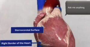 AI powered AR